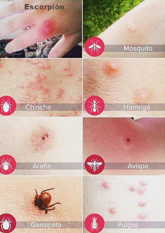 Cómo evitar las picaduras de mosquitos: mantén a raya a los insectos que pican€
€